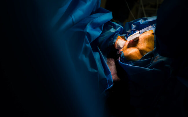 Photo de détails au bloc opératoire lors d'une opération chirurgicale photographiée au Pôle digestif Lyon Est (UCGT)